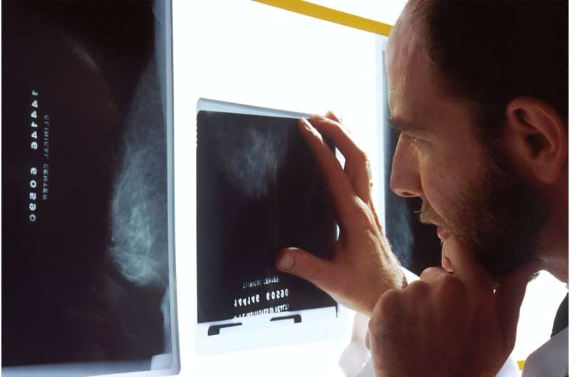 Помогает ли ИИ работе рентгенологов или вредит ей? Это зависит от врача.